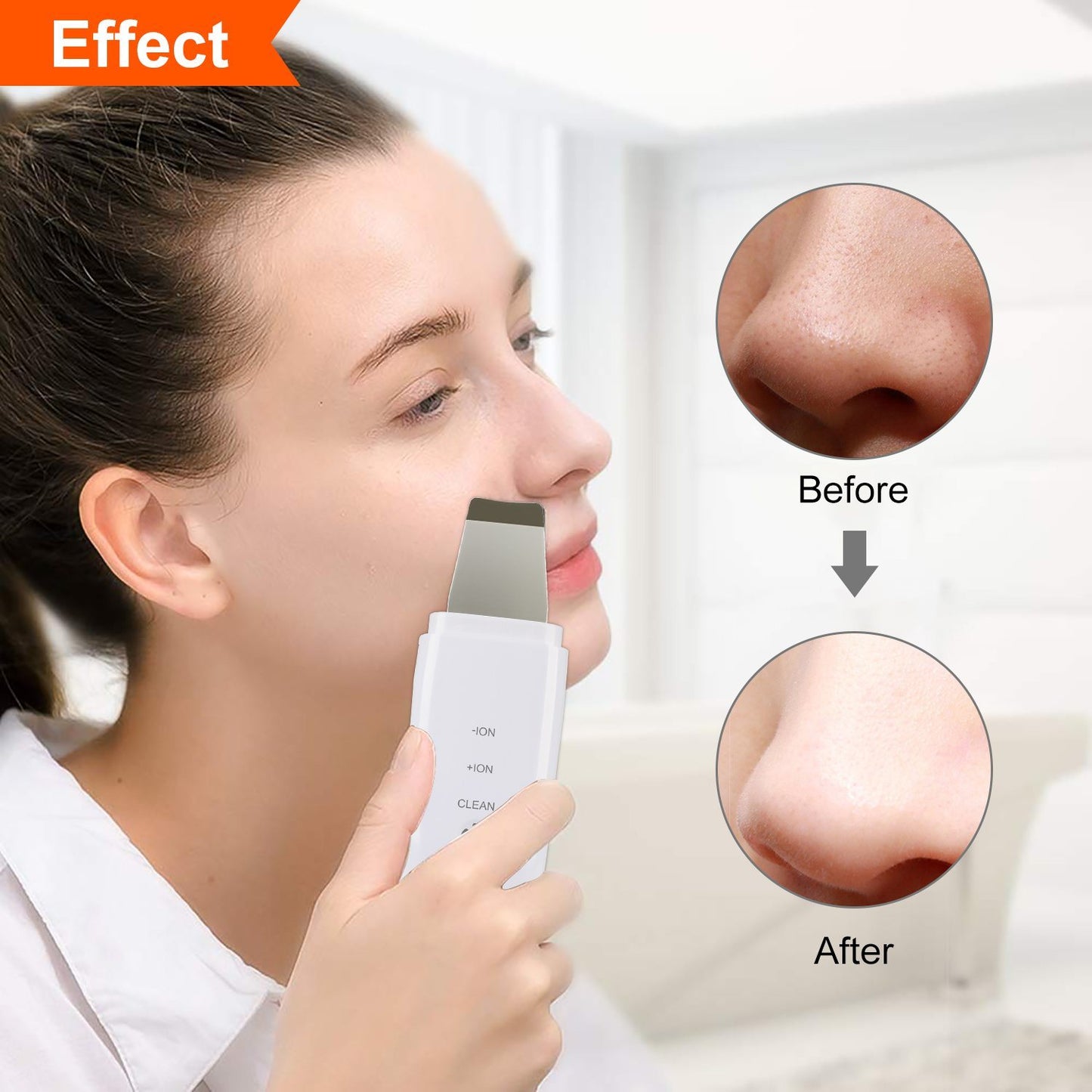 Ultrasonic Skin Scrubber & Blackhead Remover